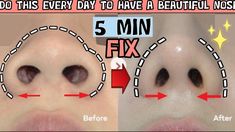 Beautiful Nose, Facial Massage Routine, Pretty Nose, Face Yoga Facial Exercises, Perfect Nose, Diy Skin Care Routine, Button Nose, Seni Dan Kraf, Nose Shapes