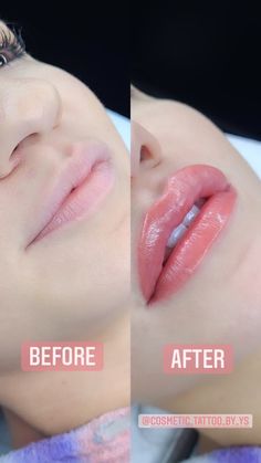 Tattooed Lips Before And After, Lip Tattoo Before And After, Lip Blushing Before And After, Lip Blushing Tattoo Healing, 1 Ml Lip Filler Before And After, Permanent Lip Color Tattoo, Lip Blushing Tattoo Colors, Lip Blushing Tattoo Before And After