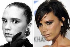 Plastic Surgery Fail, Nose Jobs, Rhinoplasty Nose Jobs, Plastic Surgery Photos, Posh Spice, Celebrity Plastic Surgery