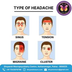 Many of us are familiar with some form of the throbbing, uncomfortable, and distracting pain of a headache. There are different types of headaches. The common types of headaches include Different Types Of Headaches, Type Of Headache, Tension Migraine, Relieve Neck Pain, Constant Headaches, Headache Types, Liver Diet, Lip Care Routine, Strengthening Exercises