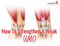 Vmo Strengthening Exercise, Vastus Medialis Exercises, Adductor Exercises, Cycling Muscles, Healthy Poster