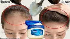 Diy Vaseline, Vaseline Hair, Vaseline Hair Tonic, Vaseline For Hair, Vaseline Original, Homemade Hair Treatments, Hair Growth Spray, Make Hair Grow, How To Grow Your Hair Faster