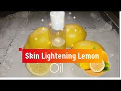 Hormonal imbalances or overexposure to sunlight can result in the development of dark spots. Read this article to know how to use lemon juice for dark spots. Facial Types, For Dark Spots On Face, Aspirin Face Mask, Wrinkles Remedies, Wrinkles Remedies Face, Age Spots On Face, Vitamin C Oil, Homemade Face Pack