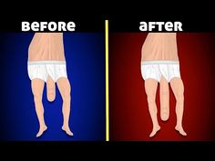 the before and after pictures of a man's legs, showing how they are able to