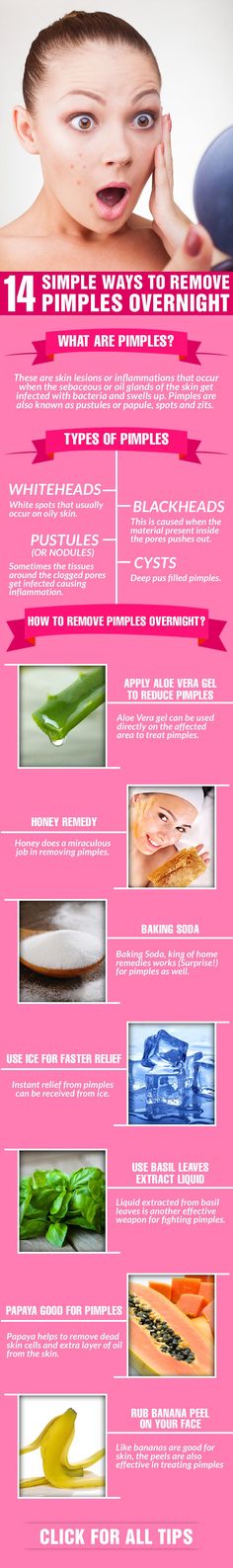 Remove Pimples Overnight, To Remove Pimples, Lotion Coconut, Remove Pimples, Overnight Face Mask, Blackhead Remedies, Skin Moles, Acne Overnight, Pimples Overnight