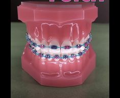 Invisalign Tips, Teeth Tips, Brace Face, Braces Colors, Dental Braces, Teeth Braces