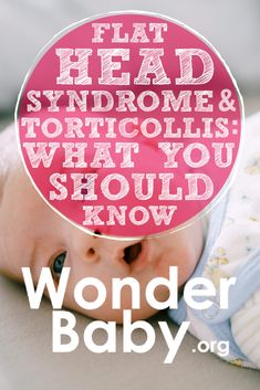 Flat Head Syndrome and Torticollis: What You Should Know Flat Head Syndrome, Baby Head, Flat Head, Spot On, Muscles