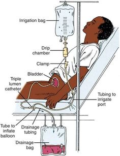 a diagram showing the parts of a woman in a hospital bed