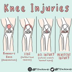 the stages of knee injuries are shown in this cartoon