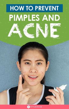 Most of us are guilty of squeezing those red and bulbous pimples that keep popping up on our faces from time to time. Checkout how to prevent acne naturally Clear Skin Fast, Bad Acne, Pimples Overnight, Crystal Makeup, Prevent Pimples, Acne Skincare, Natural Acne Remedies, Acne Spots, Acne Remedies