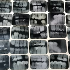 many different types of teeth are shown in black and white squares on a table top