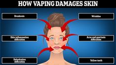 Top dermatologist reveals how vaping can age the skin by decades #DailyMail Skin Breakouts, Dermatologist Doctor, Magnet Fishing, Britain Got Talent, Stained Teeth, Look Older, Dehydrated Skin, Love Island, Skin Problems