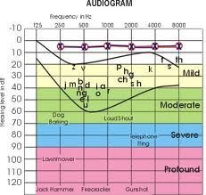 How to Read an Audiogram. Repinned by SOS Inc. Resources /sostherapy/. Deaf Education, Slp Resources, Deaf Culture, Speech Path, Speech Therapy Resources, Speech Pathology, Speech Language Therapy, Speech Language Pathology, Hearing Loss