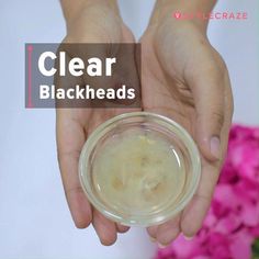 Having trouble with blackheads? Before taking to expensive chemical products, try these 13 simple steps from the comfort of your home and witness the results. Clear Blackheads, Black Heads, Chemical Products, Diy Remedies, Hair And Beauty