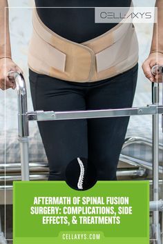 Aftermath of Spinal Fusion Surgery Complications, Potential Side Effects, Treatments Sciatic Nerve Relief, Spinal Fusion Surgery, Sciatic Nerve Pain Relief, Spinal Fusion, Spine Health, Spine Surgery, Nerve Pain Relief