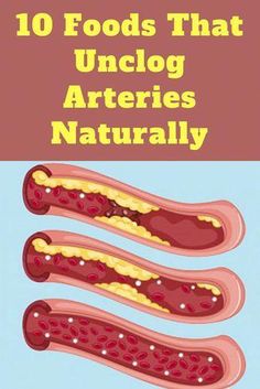 Clean Arteries, Unclog Arteries, Beach Hacks Tips And Tricks, Heart Healthy Diet, Healthy Advice, Beach Hacks, Healthy Smoothie