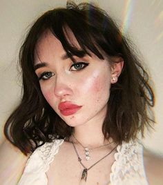 Acne doesn't have to be a bad thing—and these 10 stunning images prove it Girl With Acne, Lemon Face Mask, Acne Makeup, Coconut Oil For Acne, Foto Art, Inspiring Images, No Foundation Makeup