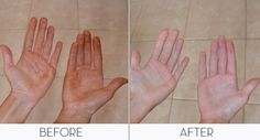 Secret to cleaning self tanner off of your hands! SO SIMPLE! Get Rid Of Tan, Tanning Skin Care, Best Tanning Lotion, Tanning Tips, Self Tanners, Sunless Tanning, Self Tanner, Tanning Lotion