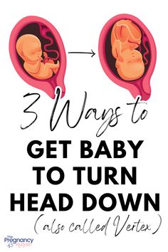 the words 3 ways to get baby to turn head down