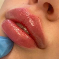 Lips Inspiration, Botox Lips, Facial Fillers, Facial Aesthetics, Lip Filler, Lip Shapes, Lip Injections, Perfect Lips, Nose Job