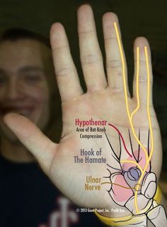 a person holding up their hand with the words hypothheria on it