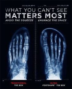 Choosing shoes for healthy feet – a practical guide to minimal footwear. Altra Shoes, Minimal Shoes, Minimalist Shoes, Womens Training Shoes, Spider Woman, Wide Shoes, Barefoot Shoes, Shoes Blue, Trail Shoes