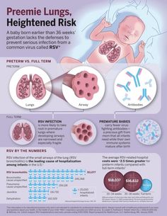 an info poster showing the different types of lungs