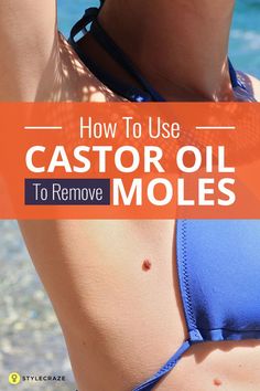 How To Use Castor Oil To Remove Moles Remove Moles, Skin Moles, Skin Growths, Mole Removal, Acne Scar Removal, Natural Cough Remedies, Oil Uses