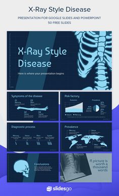 the x - ray style powerpoint presentation is shown