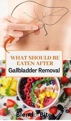 Post Gallbladder Surgery Diet, No Gallbladder Diet, Gallbladder Surgery Diet, Gallbladder Removal Diet, No Gallbladder, Healthy Eating Routine, After Gallbladder Surgery, After Gallbladder Removal, Gallbladder Removal