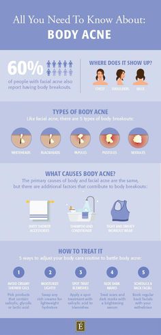 Face Pimples, Body Breakouts, Acne Body Wash, Chest Acne, Eminence Organic Skin Care, Types Of Acne, How To Get Rid Of Pimples, Body Acne