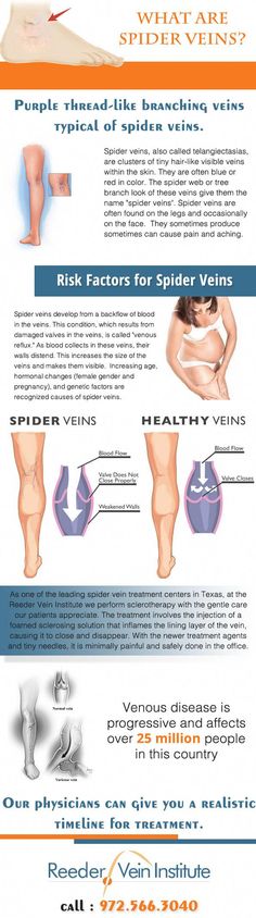 Visible Veins, Venous Insufficiency, Keratosis Pilaris, Excessive Sweating, Abdominal Pain, Health Info, Skin Conditions, Skin Health, Cider