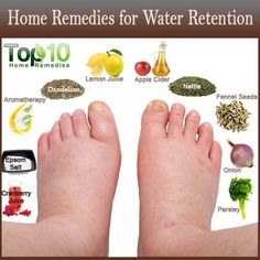 Home Remedies for Water Retention Constipation Remedies, Top 10 Home Remedies, Water Retention, My Shoes, Natural Home Remedies, Find Yourself, Natural Medicine