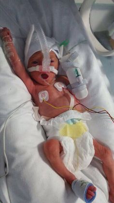 a baby in a hospital bed with an oxygen tube attached to it's head