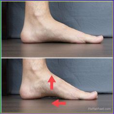 the foot is shown with an arrow pointing up to it's toe and bottom