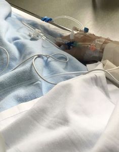 an iv in a hospital bed with blue and white sheets