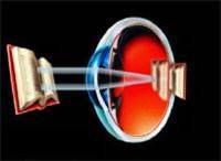 Hyperopia or Farsightedness is a condition in which the distance between the cornea and the retina is too short or the actual shape of the eye is too flat. This causes light images to focus behind the retina, causing blurred vision. http://arizonacataract.com/eye-problems/refractive-errors/hyperopia-farsightedness/ Laser Vision Correction, Eye Function, Lasik Eye Surgery, Laser Vision, Blurred Vision, Focus Images, Lasik Surgery, Blurry Vision, Car Batteries