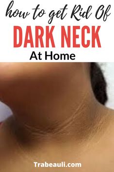 Want to know How to Get Rid of Dark Neck, causes, effective home remedies and treatments. Yes, so check out for complete details and DIY Get Rid Of Dark Neck, Dark Neck, Dark Circles Under Eyes, Simple Home, Natural Home Remedies, Natural Home, Beauty And Lifestyle