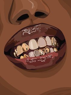 a woman's mouth with braces and gold teeth