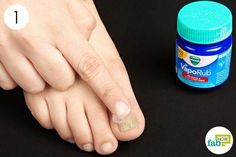 Toenail Fungus Essential Oils, Bad Nails, Toenail Fungus Remedies, Fungal Nail, Peinados Recogidos, French Tip Acrylic Nails, Vicks Vaporub, Toenail Fungus, Colon Cleanse