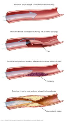 an image of different types of blood vessels and their functions in the body, with text below