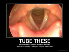 an image of the inside of a person's mouth with text that reads tube these