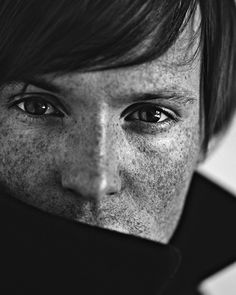 black and white photograph of a man with freckled hair covering his face, looking directly into the camera