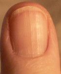 Ridges on nails mean you need vitamin B 12, and other things your nails may be telling you-- very informative article. Low Vitamin B12, Fingernail Health, Nail Health, Vitamin B12, Vitamin B