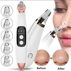 Blackhead Remover Machine Description: Compact Blackhead Clean Machine, Which Is A Beauty Instrument With Many Functions, Like Dermabrasion, Compact, Clean Pores, Acne Remove And Blackhead Suction. There Are 6 Different Sized Replacement Suckers, Which Can Be Adjusted According To Your Actual Needs. Pore Sucker, Acne Remove, Led Light Mask, Home Remedies For Pimples, Led Light Therapy Mask, Pmd Beauty, Derma Pen, Light Therapy Mask, Light Mask