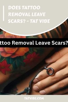 a woman with tattoos on her arm and the words does tattoo removal leave scars - tat vibe?