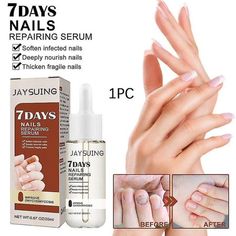 Jaysuing 7-Day Nail Repair Essence is a repair solution specially designed for hand and foot nail problems. It uses a variety of high-quality nutrients and natural plant essences, which can penetrate deep into the root of nails, reduce the occurrence of various nail problems such as ingrown nails, thickened onychomycosis, and achieve short-term 7-day repair of nail growth and care for health. The high-efficiency care ingredients of this nail repair essence can promote the growth and repair of na Nails Growth, Nails Repair, Cracked Nails, Nail Serum, Nail Problems, Ingrown Nail, Best Nails, Fungal Nail, Nail Repair