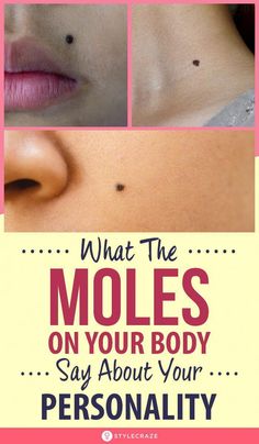 Moles can appear just about anywhere on your body - face, arms, legs, palms, and even your chest for crying out loud! And while you desperately Moles On Face, Skin Moles, Skin Growths, Face Reading, Unhealthy Diet, Taichung, Lose 40 Pounds, Flawless Skin, Style Mistakes