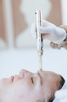 Can you wear makeup after microneedling? Skin Pharm has everything you need to know about this amazing skin care treatment and its aftercare recommendations. Micronidelling Face, Skin Pharm, After Microneedling, 2023 Photoshoot, Microneedling Pen, Blind Pimple, Skin Needling, Pimples Under The Skin