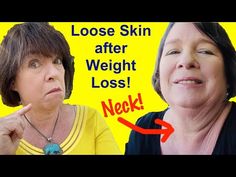 Turkey Neck, Vagus Nerve, Loose Skin, Nerve, Face Paint, Bee, Diet